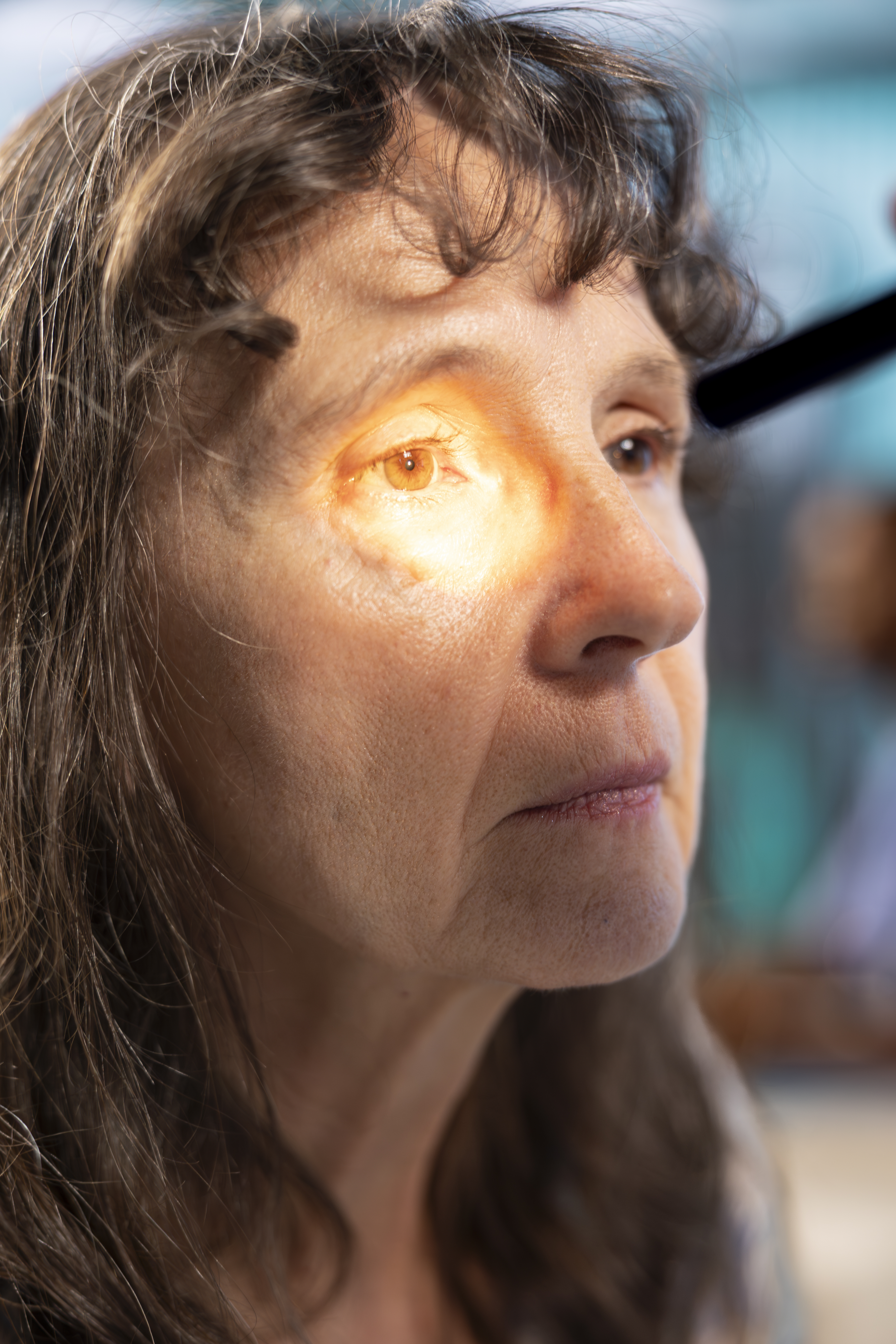 Öt tény és tévhit a szürkehályog műtétről: Amiről a páciensek gyakran nem tudnak