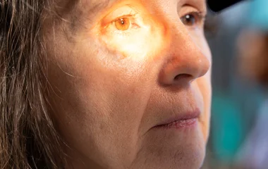 Öt tény és tévhit a szürkehályog műtétről: Amiről a páciensek gyakran nem tudnak